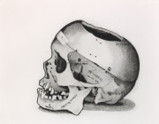 Dr. R’s Skull (State I)